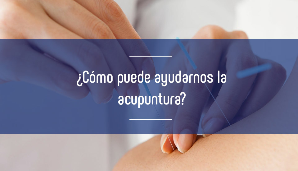 ¿Cómo puede ayudarnos la acupuntura?