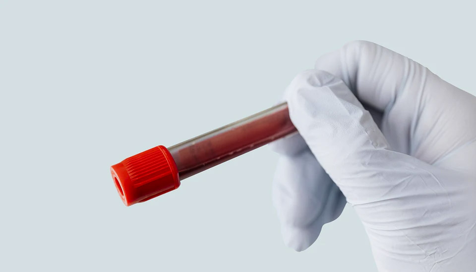 analisis de sangre Lugo