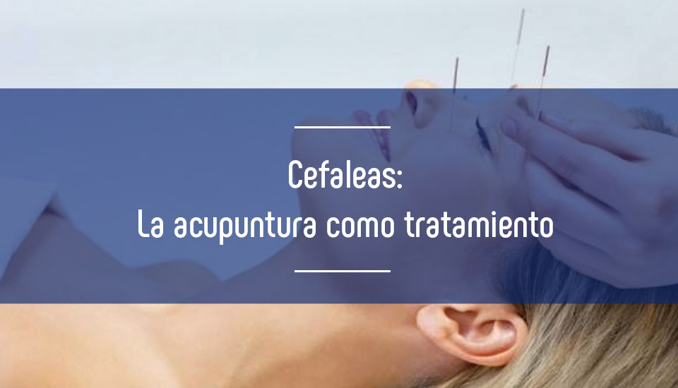 Eficacia analgésica de la acupuntura en pacientes con cefalea aguda Eficacia analgésica de la acupuntura en pacientes con cefalea aguda