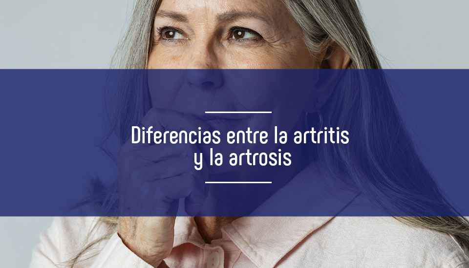 Diferencias entre la artrosis y la artritis - Prueba desintometría ósea Diferencias entre la artrosis y la artritis - Prueba desintometría ósea