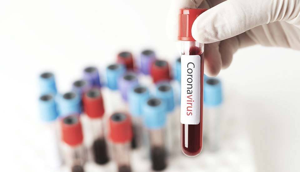 pruebas covid 19 en Lugo pruebas covid 19 en Lugo