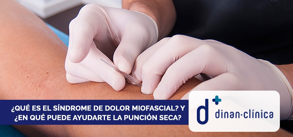 Dolor miofascial con punción seca en Lugo y Monforte